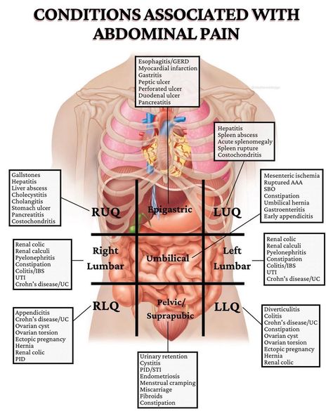 Stephanee Beggs, RN, BSN on Instagram: “WHAT’S CAUSING YOUR ABDOMINAL PAIN? I’m dropping some veryyy important conditions related to each quadrant of the abdomen!!! “Why do I…” Abdominal Quadrants And Organs, Gastrointestinal Nursing, Body Knowledge, Medicine School, Quadrants Of The Abdomen, Anatomy Organs, Study Goals, Basic Anatomy, Medical Pins