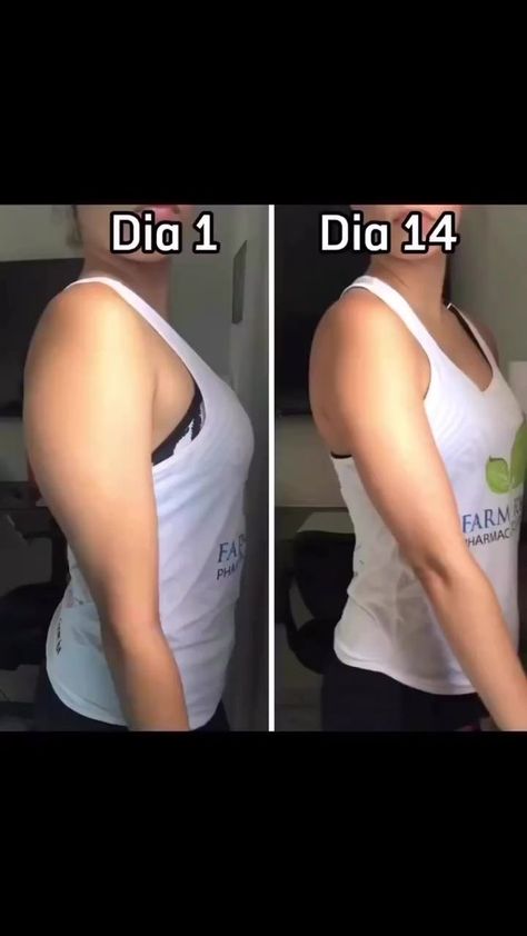 Getting there ... Hehhehe #fbreels #fbreelsvideo #weightlossjourney #momexercise #athomeworkouts #beautifulmonster #meletmelet #simpleexercise #burning #armexercises #letsdoittogether #hotmom | Analyn Diez Abarte | Analyn Diez Abarte · Original audio Skin Exercise, Reduce Arm Fat Exercise, Arm Fat Exercises, Reduce Arm Fat, Lose Arm Fat, Arm Fat, Trening Fitness, Quick Workout Routine, Bodyweight Workout Beginner