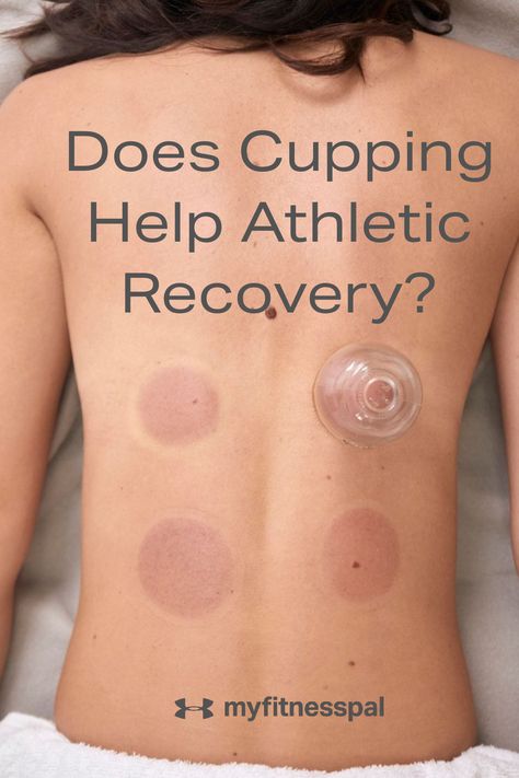 Dry Cupping Therapy, Myofascial Cupping, Dry Cupping Therapy Chart, Cupping Therapy Chart Back Pain, Pt Logo, Athletic Recovery, Hijama Cupping Therapy, Fitness Recovery, Fire Cupping