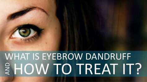 What Is Eyebrow Dandruff and How to Treat It Eyebrow Dandruff, Are You Experienced, Flaky Skin, Beauty Tutorials, Latest Hairstyles, Dandruff, Creative Ideas, Healthy Skin, Eyebrows