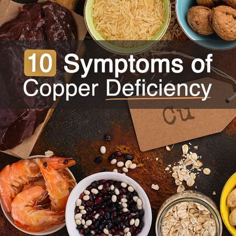 Copper Deficiency, Copper Benefits, Adrenal Health, Healthy Happy Life, Nutrient Deficiency, Power Foods, Nutritional Deficiencies, Hormone Health, Nutritional Supplements