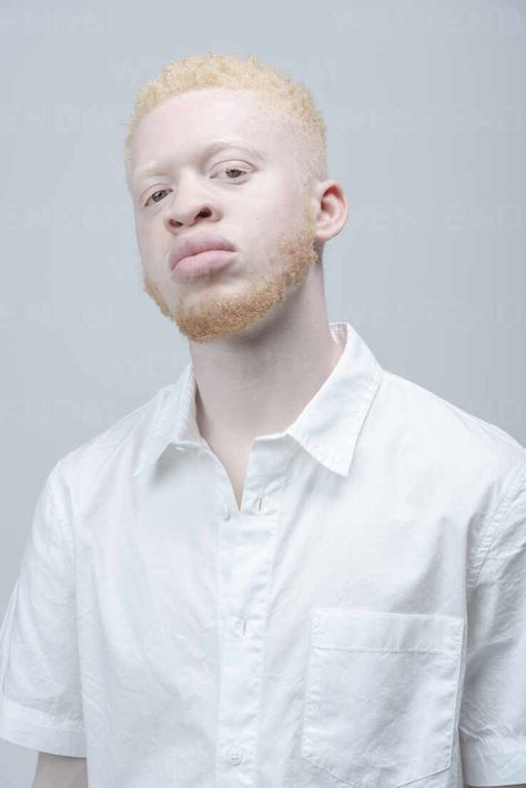 Albino Black Men, Albino Men Black, Albino Skin, Albino People, Black Man White Hair Art, Black Albino, Black Albino Man, Albino Black People, Albino Black Woman