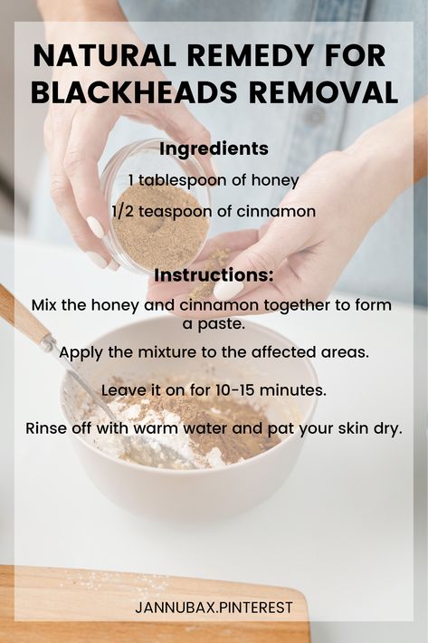 Natural home Remedy for blackheads by using Honey and Cinnamon Mask Home Remedy For Blackheads, Remedy For Blackheads, Blackhead Remedies, Trending Skincare, Diy Masks, For Blackheads, Skincare Hacks, Honey And Cinnamon, Tighten Pores