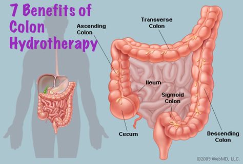 Clostridium Perfringens, Sigmoid Colon, Colon Cleanse Recipe, Cleaning Your Colon, Constipation Remedies, Colon Detox, Natural Colon Cleanse, Naturopathic Doctor, Colon Cleanse