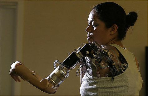 mechanical (computer operated) prosthetic limb Bionic Arm, Robotic Arm, Bionic Woman, Future Tech, A Robot, Medical Technology, Ex Machina, Future Technology, Cool Tech