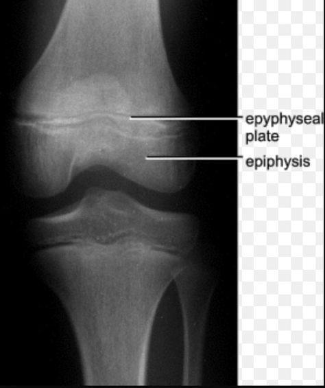 Synchondroses joint in epiphyseal plate: synarthrosis , one kind of cartilaginous joint . Connecting tissue is hyaline cartilage Epiphyseal Plate, Hyaline Cartilage, Handwritten Quotes, Free Education, Occupational Therapy, Education, Quotes, Photography, Quick Saves