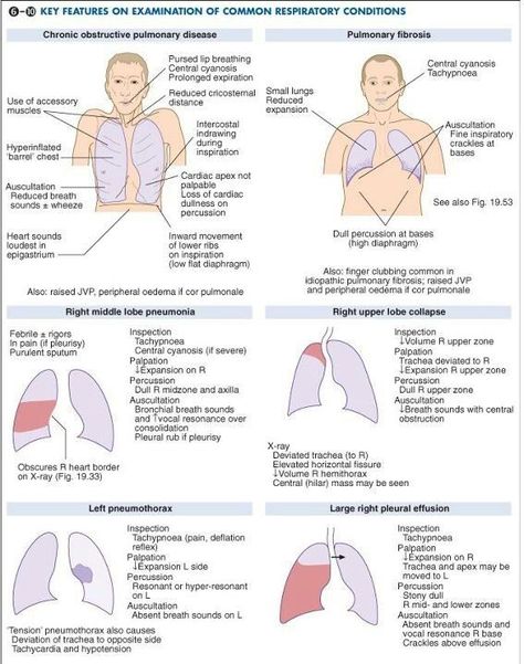 Common respiratory conditions Emt Study, Nursing Information, Nursing Assessment, Nursing Mnemonics, Pulmonology, Respiratory Care, Critical Care Nursing, Nurse Rock, Respiratory Therapy