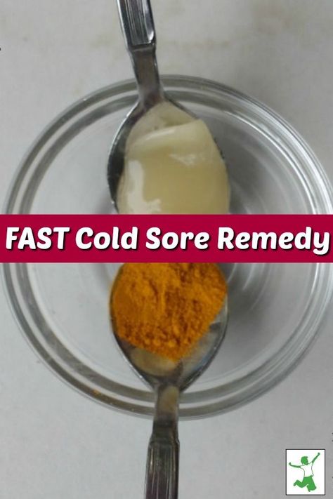 Cold sores or fever blisters, most people get them. There are some wonderful natural remedies to help with the cold sores. Come find out about three fast cold sore remedies that you could be using today! #coldsores #coldsoreremedies #coldsoreremedy #feverblisters #feverblisterremedy #feverblisterremedies #naturalremedies #mrsjonescreationstation Heal Cold Sores Fast, Cold Sore Remedy Fast, Fever Blister Remedy, Cold Remedy Tea, Cold Sore Remedies, How To Heal Blisters, Natural Cold Sore Remedy, Home Remedies For Fever, Natural Remedies For Fever