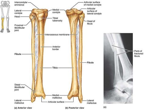 FIGURE 7.29 The tibia and fibula of the right leg. | Flickr Skeletal System, Human Body Anatomy, Study Board, Medical Imaging, Body Anatomy, Nursing School, Anatomy, Human Body, Medical