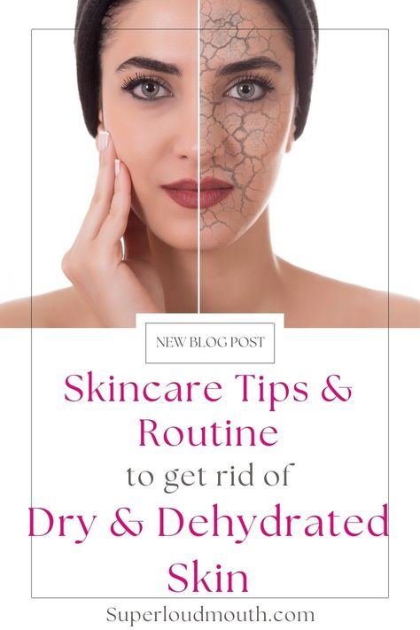 Skincare Routine and Tips to get rid of Dry, Dehydrated Skin Skin Condition, Mario Badescu, Skincare Tips, Dehydrated Skin, Skin Tips, Aging Skin Care, Flawless Skin, Skin Conditions, Skin Type