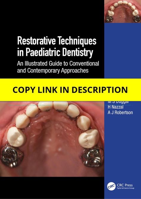 (PDF) Restorative Techniques in Paediatric Dentistry: An Illustrated Guide to Conventional and Contemporary Approaches Free Teeth Diseases, Dental Restoration, Dental Braces, Restorative Dentistry, Family Dentist, Pediatric Dentistry, Family Dentistry, Chosen Family, Ppt Presentation