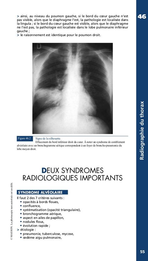 Radiographie thoracique du livre manuel pratique d'anesthésie