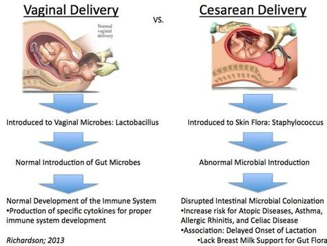 Child Delivery, Cesarean Delivery, Nursing 101, Child Nursing, Functional Nutrition, Baby Delivery, Health Literacy, Nursing Care Plan, Nursing School Survival