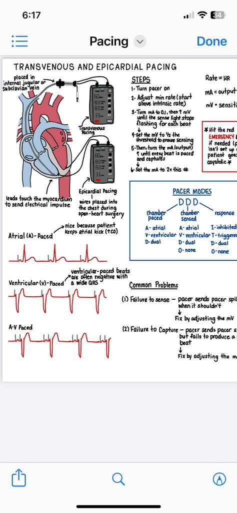 Cardiac Critical Care Nursing, Cardiovascular Notes, Respiratory Therapy Notes, Paramedic Study, Telemetry Nursing, Crna School, Cardiology Nursing, Nursing School Inspiration, Home Health Nurse