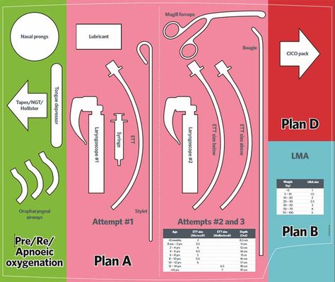 Vs Template, Anesthesia School, Crna Nurse Anesthetist, Emt Study, Nurse Anesthesia, Paramedic School, Airway Management, Nurse Anesthetist, Nursing Mnemonics