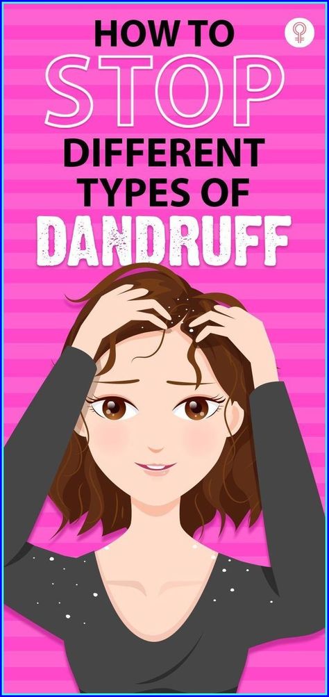 Bonus tip for you: Avoid using hair products with alcohol as it can dry out your hair. #haircare #hair #hairfall Dandruff Remedy Severe, Dandruff Causes, Dandruff Flakes, Dandruff Remedy, Getting Rid Of Dandruff, Best Hair Care Products, What To Use, Itchy Scalp, Beauty Remedies