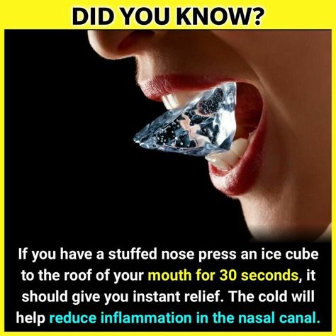 The 'Facts Encyclopedia' Instagram Is Dedicated To Sharing Unknown Facts Daily, Here're 40 Of The Most Fascinating Ones Unbelievable Facts Did You Know, Clogged Nose, Heart Facts, Unusual Facts, Strange Facts, True Interesting Facts, Cool Science Facts, Amazing Science Facts, Bff Quotes Funny