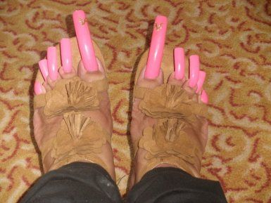 . Ugliest Nails, Gross Nails, Ugly Toes, Nails Meme, Ugly Toenails, Ugly Nails, Long Black Nails, Ugly Things, Bad Nails