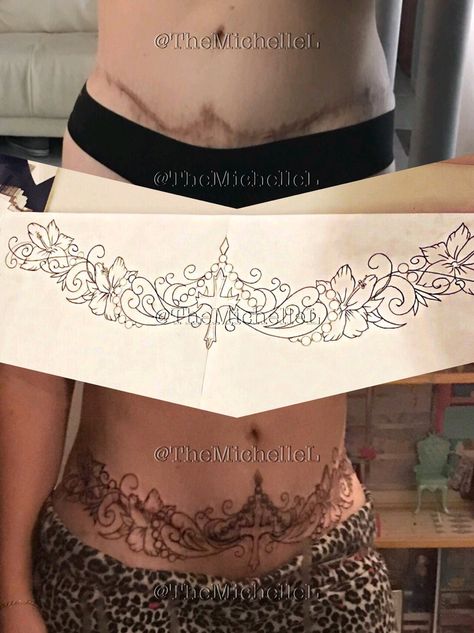 Stomach scar cover up tattoo. C section cover up tattoo. Done by Andy G Tattoo Shop in Lincoln NE. Tummy tuck tattoo Scar Cover Up Tattoo, C Section Scar Tattoo, C Section Tattoo, Tummy Tattoo, Bilateral Mastectomy, Tattoo Over Scar, Stomach Tattoos Women, Mastectomy Tattoo, Scar Cover Up