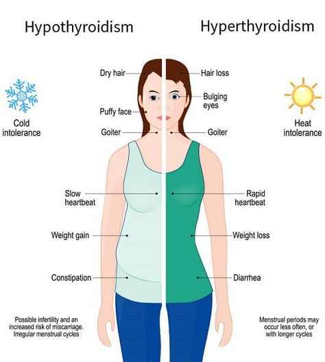 Learn about thyroid health and what is considered a dangerously high TSH level in this informative guide. - #AbnormalTSH #CriticallyhighTSHlevel #DangerouslyelevatedTSH #ElevatedTSH #Excessivelyelevatedthyroid-stimulatinghormonelevel #ExtremelyhighTSH #HealthrisksofhighTSH #HighTSHlevels #HighTSHsymptoms #ImpactofhighTSH #ManagingelevatedTSH #Thyroiddisorders #Thyroidfunction #thyroidhealth... High Tsh Levels, What Is Thyroid, Irregular Menstrual Cycle, Bulging Eyes, Natural Hair Mask, Fetal Development, Thyroid Function, Thyroid Gland, Pelvic Pain