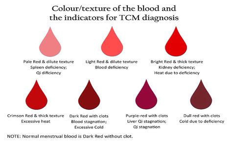 Menstrual Blood Problems: Clots, Color, and Thickness In this article What happens during a menstrual period, and how long does it last? Are clots and thicker menstrual blood unusual during a period? Are darker colors and thicker flows normal in menstrual blood? What causes menstrual blood problems? How are menstrual bleeding problems diagnosed? When should I see a doctor for menstrual bleeding problems? Healthy Period, Period Color, Period Hacks, Period Cramps, Menstrual Health, Menstrual Period, Rustic Colors, Abdominal Pain, Chinese Medicine