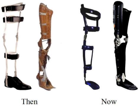 Tina's leg brace Adaptive Devices, Leg Injury, Prosthetic Leg, Leg Braces, Leather Apron, Mobility Aids, Poor Posture, Knee Brace, Fitness Gifts