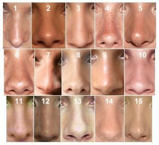 Different nose shapes, can be used as a reference in drawing a face. Types Of Nose, Different Nose Shapes, Body References, Face Anatomy, 얼굴 드로잉, Výtvarné Reference, Nose Drawing, Face Drawing Reference, Nose Shapes