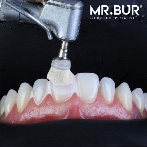 MR.BUR™ carries a wide selection of Dental Burs. http://mrbur.com admin@mrbur.com Direct contact : https://wa.link/fekhby #mrbur #dentalburs #malaysia #toothpreparation #burs #dentists #best #dentistry #teeth #dentistlife #tooth #smile #dentalcare #prosthodontics Dentist Photography, Dental Instagram, Dental Animation, Dental Burs, Dental Advertising, Dental Photos, Dental Education, Dental Fillings, Medical Animation