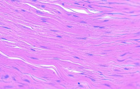 These tissues form tendons and ligaments. They consist of tightly packed bundles of collagen fibers that are slightly wavy and may stretch a little bit. This tissue forms the fascia, which is a membrane that surrounds the muscles, blood vessels, and nerves. Tendinitis often occurs in this tissue due to lack of blood supply. Anatomy Tissues, Tissues Anatomy, Dense Connective Tissue, Skin Histology, Anatomy And Physiology Study, Physiology Study, Microscopic Cells, Lab Image, Histology Slides