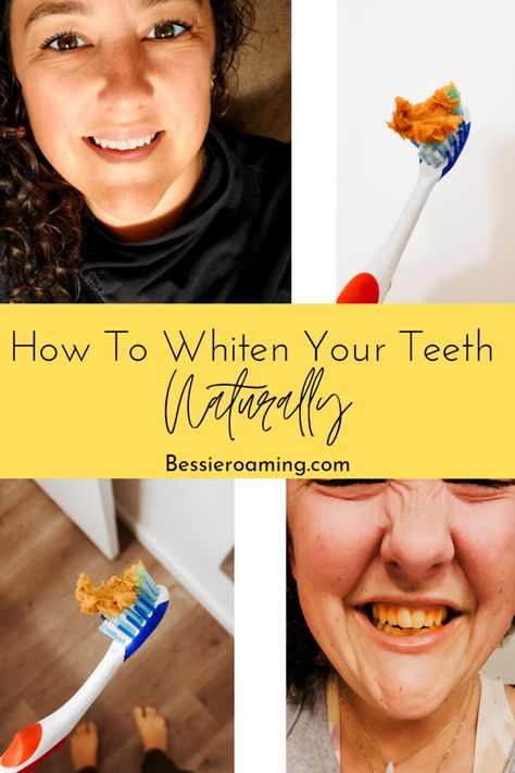 Whiten Teeth Naturally, Teeth Whiting At Home, Teeth Whitener, Teeth Whitening Remedies, Teeth Whitening Diy, Dental Cavities, Whiten Teeth, Yellow Teeth, Teeth Health