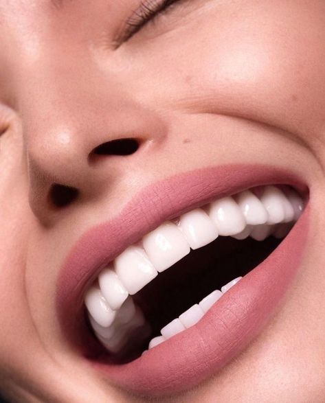 Perfect Smile Teeth, Tooth Extraction Healing, Teeth Aesthetic, Pretty Teeth, Sensitive Teeth Remedy, Get Whiter Teeth, Teeth Whitening Diy, Wisdom Teeth Removal, Beautiful Teeth