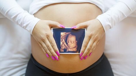 Twin Baby Shower Theme, 3d Ultrasound, Unique Pregnancy Announcement, Medical Ultrasound, 4d Ultrasound, Surrogate Mother, Baby Scan, Ultrasound Pictures, Unborn Baby