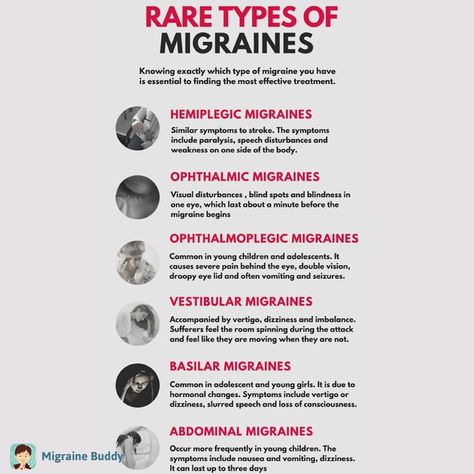 Causes Of Migraine Headaches, Silent Migraine, Migraine Art, Getting Rid Of Migraines, Types Of Migraines, Migraine Help, Migraine Triggers, Migraine Pain, Migraine Prevention