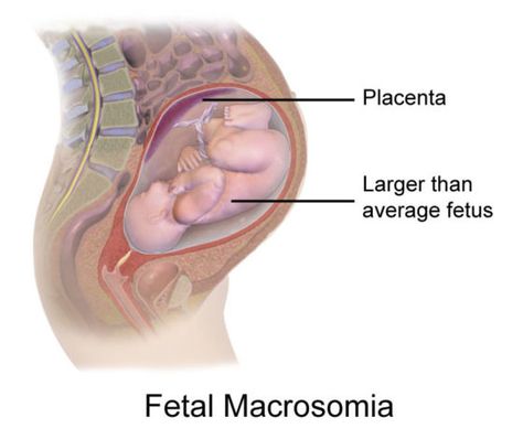 Gestational Age, Premature Birth, Maternal Health, Unborn Baby, Health Screening, High Risk, Health Conditions, Prenatal, Nursing School