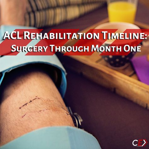 Acl Pt Exercises, Acl Recovery Exercises Workouts, Acl Prehab Exercises, Acl And Meniscus Surgery Recovery, Acl Recovery Quotes, Acl Surgery Recovery Tips, Acl Recovery Timeline, Torn Acl Exercises, Post Acl Surgery