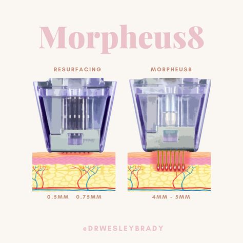 Morpheus 8 Before And After, Morpheus Aesthetic, Morpheus 8, Micro Needling, Facial Tools, Medical Marketing, Botox Fillers, Skin Resurfacing, Aesthetic Clinic