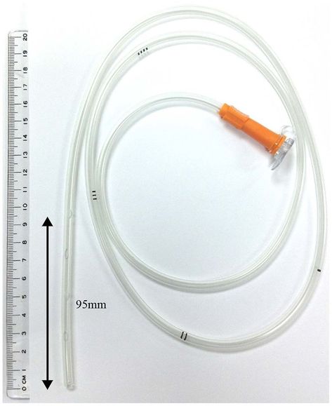 An NG tube, or naso-gastric tube, is a flexible tube inserted through the nose (nasal passage) and down into the stomach. It's used for a variety of medical purposes, such as: Feeding: Providing nutrition directly to the stomach when a patient cannot eat by mouth. Medication Administration: Delivering medications directly to the stomach. Decompression: Removing gas or liquid from the stomach to relieve pressure. Sample Collection: Taking samples of stomach contents for analysis. Stomach Clean... Ng Tube, Tube Feeding, Medication Administration, Nasal Passages, Feeding Tube, Google Images, Quick Saves