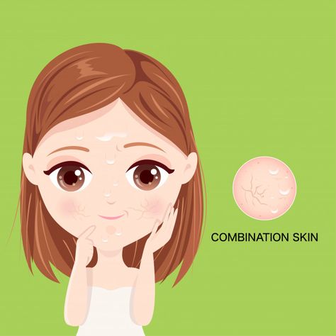 Face Mapping Acne, Face Mapping, Dry Skin On Face, Skincare Quotes, Acne Causes, Face Acne, Love Your Skin, Beauty Illustration, Face Skin Care