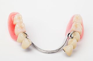 How to Take Care of Your Dentures - Pasadena Dentist Removable Partial Denture, Dental Pictures, Affordable Dentures, Teeth Whitening Dentist, Dental Images, Teeth Whitening Procedure, Denture Implants, Dental Restoration, Dental Website