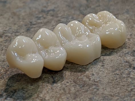 Zirconia Crowns Teeth, Dental Notes, Ceramic Stains, Dental Prosthesis, Aesthetic Dental, Dental Ceramics, Dental Wallpaper, Dental Images, Dental Posts