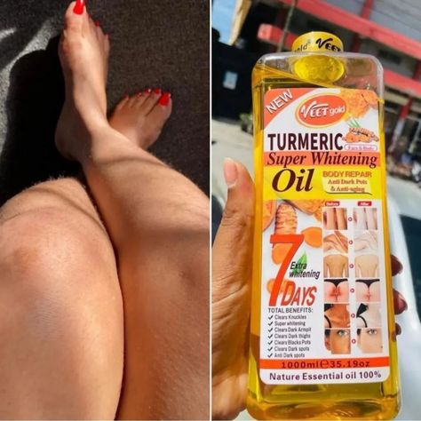 Veet Gold Turmeric Oil Tumeric Oil For Skin, Clear Dark Spots, Face Lightening, Perfect Skincare Routine, Gold Skincare, Hair Nutrients, Turmeric Oil, Acne Gel, Turmeric Extract