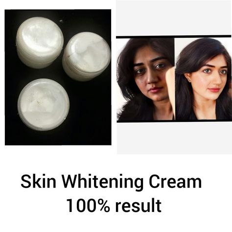 Skin Whitening Cream Shipping All Over The World Prize - 500/- Fairness Cream, Fair Complexion, Fade Dark Spots, Even Out Skin Tone, Whitening Cream, Skin Care Tools, Dark Spots, Skin Tone, Your Skin