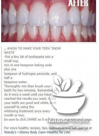 Best Teeth Whitening Kit, Teeth Whitening Homemade, Teeth Whitening Diy, Diy Teething, Charcoal Teeth Whitening, Gravity Fall, Teeth Whitening Strips, The Nanny, Nice Teeth