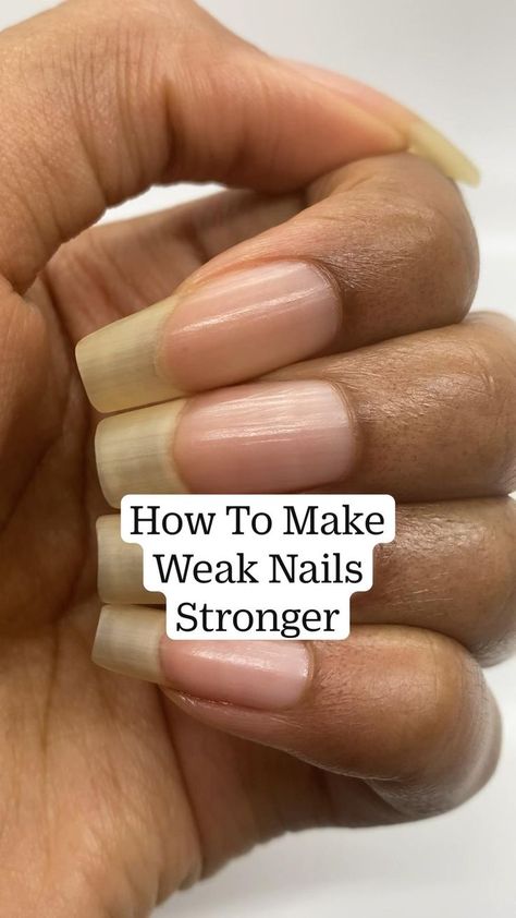 How To Make Weak Nails Stronger in 2022 | Weak nails, Nail growth tips, Nail care Nails Stronger, Grow Long Nails, Nail Growth Tips, Weak Nails, Nagel Tips, Nail Care Routine, Nail Care Tips, How To Grow Nails, Brittle Nails