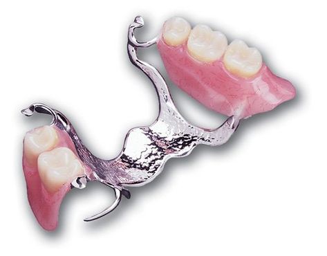 Removable Partial Denture, Free Dental Implants, Dental Posts, Missing Tooth, Dental Videos, Teeth Art, Dental Fun, Partial Dentures, Dental Technician