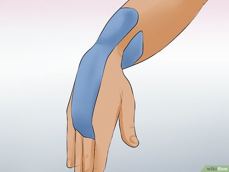 3 Ways to Wrap a Wrist for Carpal Tunnel - wikiHow Carple Tunnel, Carpal Tunnel Exercises, Carpal Tunnel Relief, Median Nerve, Kinesio Tape, Kt Tape, Wrist Injury, Kinesio Taping, Pituitary Gland