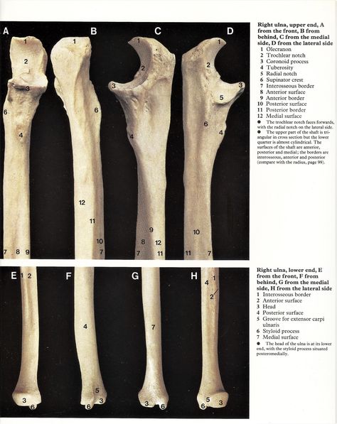 Osteology Aesthetic, Anatomy Diagrams, Diagram Drawing, Medical Illustrations, Basic Anatomy And Physiology, Musculoskeletal System, Human Anatomy And Physiology, Medical Anatomy, Bones And Muscles