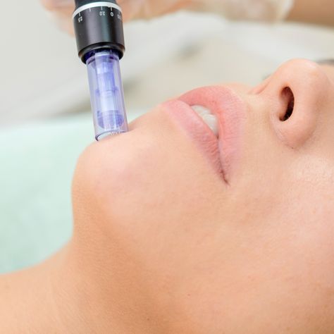 Microneedling aftercare is just as important as the facial procedure itself. Read up on these microneedling post care tips to maintain your gorgeous glow! Microneedling Post Care, Facial Procedure, Skin Moles, Uneven Skin Texture, Aesthetic Clinic, Pink Skin, Laser Skin, Skin Clinic, Gentle Cleanser