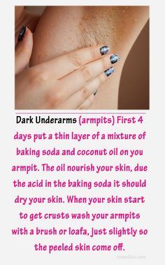 Whiten Underarms Fast, For Dark Underarms, Whiten Underarms, How To Whiten Underarms, Dark Armpits, Underarm Whitening, Dark Underarms, Diy Kosmetik, Natural Cleanser