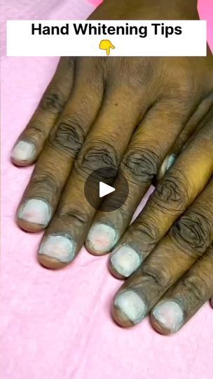 1.9M views · 8.2K reactions | Rid of dark knuckles at home | Permanent hand whitening formula ✋

#skincarenatural #skintreatment #facepack #glassskin #viral #reels #skincarehacks #knuckles #handwhitening #handremedy #tipsglowing #glowingskin #beautytutorial #skincareviral #skincarekorea #glowingskincaretips | Beauty Tips Ayurvedic Hand Whitening, Dark Knuckles, Daily Beauty Tips, Viral Reels, Lighten Skin, Beauty Tutorials, Glass Skin, Clean Skin, Skin Treatments